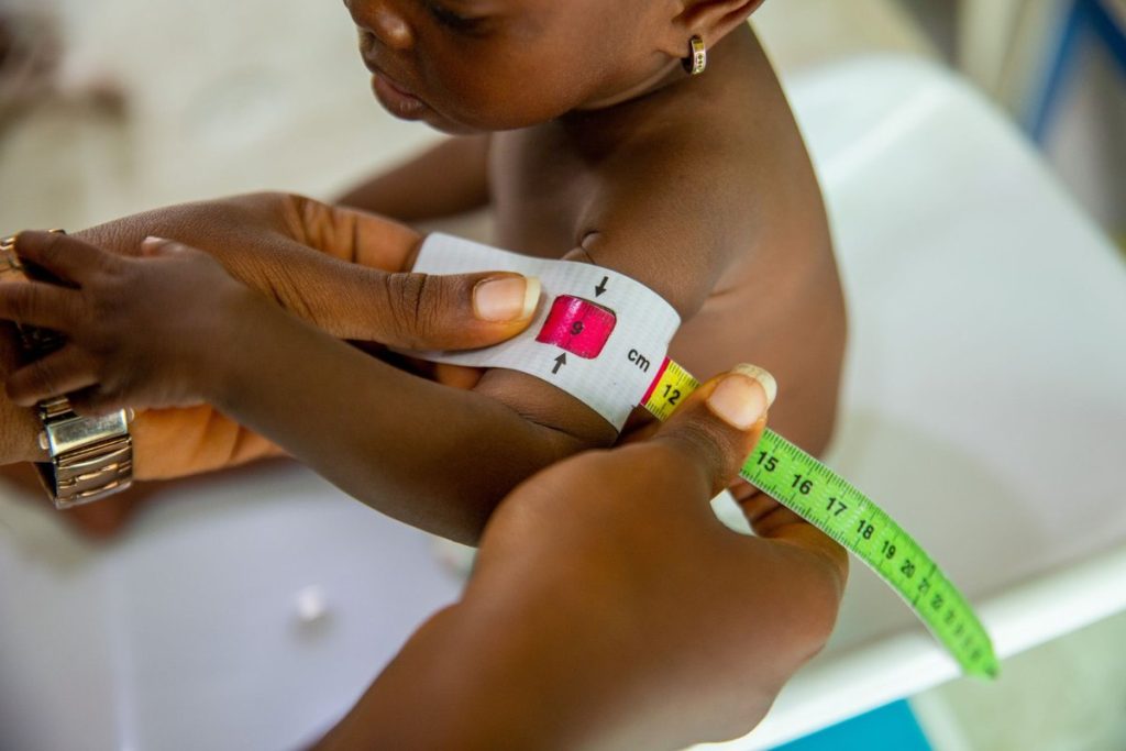 dénutrition de la personne âgée