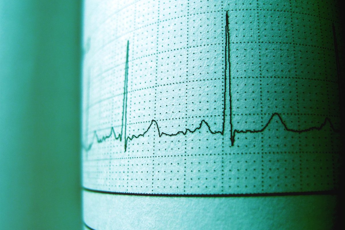 rythme cardiaque quand on est malade